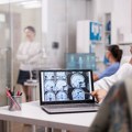 Neurološke promene u starijem dobu: Kada su zaboravnost i usporenost deo starenja, a kada znak za pregled