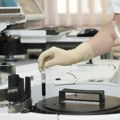 Revolucija u medicini Dijagnostikovanje Alchajmerove bolesti uskoro na osnovu analize krvi