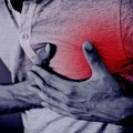 U Srbiji svakog dana oko 50 srčanih udara: Rehabilitacija smanjuje smrtnost za 25 odsto